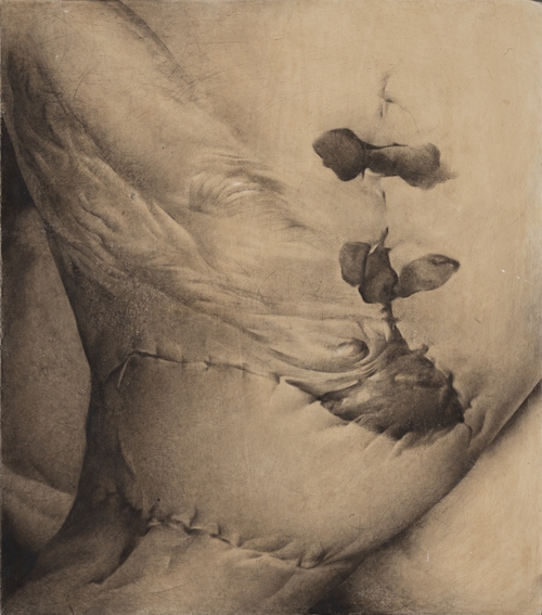 The Wound (3)