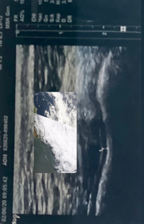 Amniotic Black Sea by Kryvych