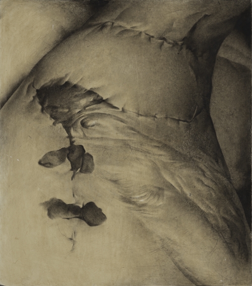 The Wound (3) by Krystyna Melnyk